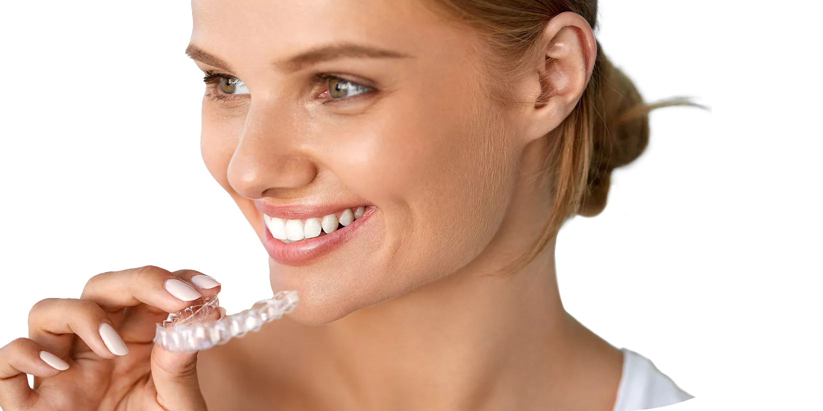 Comprehensive orthodontic treatment in Delta