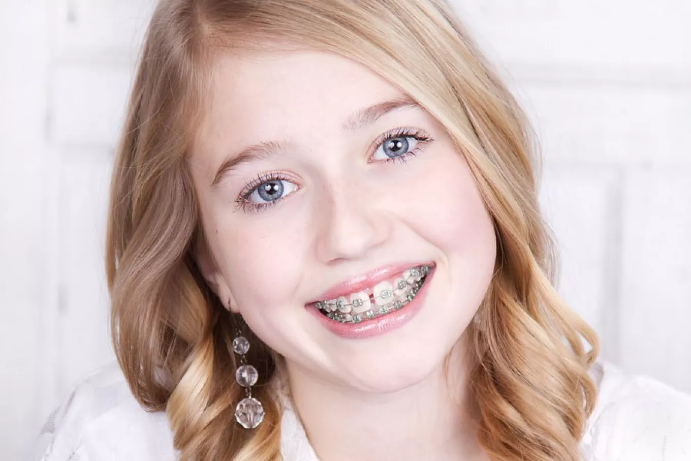Helping Your Child Adjust to Life With Braces