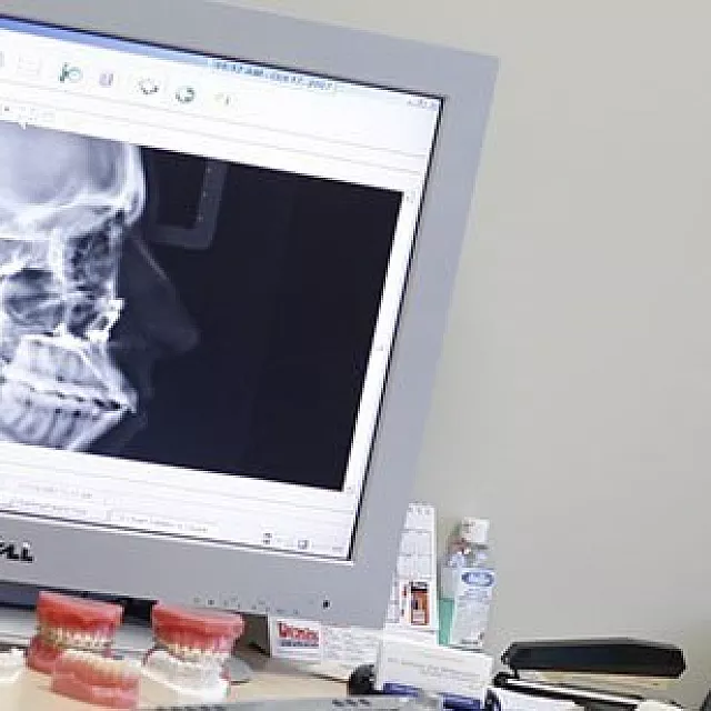 Beyond Straight Teeth: What is Functional Orthodontics?