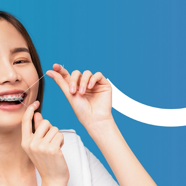 Your Essential Guide to Caring for Braces (Braces Care Guide)